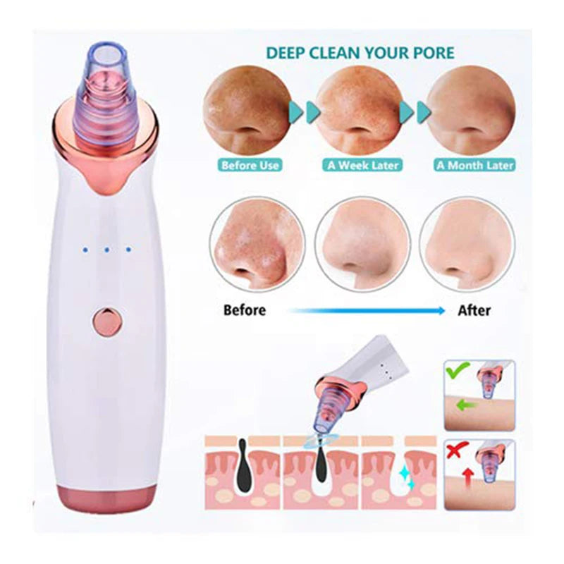 Facial Blackhead Remover Pore Acne Pimple Removal Face Nose Cleaner Vacuum Suction Facial Diamond Beauty Clean Skin Oil Dirty